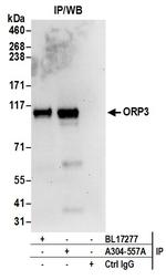 ORP3 Antibody in Immunoprecipitation (IP)