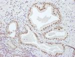 PCYT1A Antibody in Immunohistochemistry (Paraffin) (IHC (P))