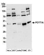 PCYT1A Antibody in Western Blot (WB)