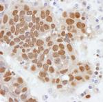 PCYT1A Antibody in Immunohistochemistry (Paraffin) (IHC (P))