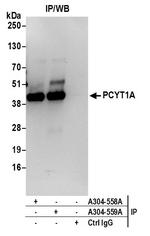 PCYT1A Antibody in Immunoprecipitation (IP)
