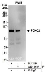 FCHO2 Antibody in Immunoprecipitation (IP)
