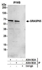 GRASP65 Antibody in Immunoprecipitation (IP)