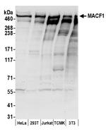 MACF1 Polyclonal Antibody
