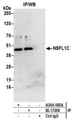 NSFL1C Antibody in Immunoprecipitation (IP)