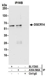 DGCR14 Antibody in Immunoprecipitation (IP)