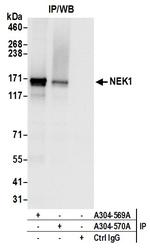 NEK1 Antibody in Immunoprecipitation (IP)