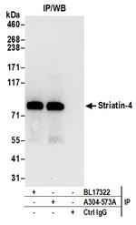 Striatin-4 Antibody in Immunoprecipitation (IP)