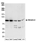 Striatin-4 Polyclonal Antibody
