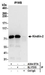 Kindlin-2 Antibody in Immunoprecipitation (IP)