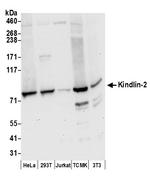Kindlin-2 Polyclonal Antibody