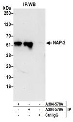 NAP-2 Antibody in Immunoprecipitation (IP)