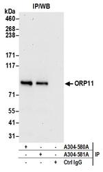 ORP11 Antibody in Immunoprecipitation (IP)