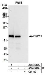 ORP11 Antibody in Immunoprecipitation (IP)
