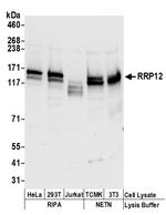 RRP12 Polyclonal Antibody
