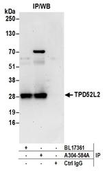 TPD52L2 Antibody in Immunoprecipitation (IP)
