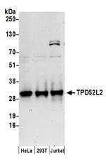 TPD52L2 Antibody in Western Blot (WB)