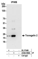 Transgelin 2 Antibody in Immunoprecipitation (IP)
