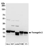 Transgelin 2 Polyclonal Antibody