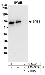 EPI64 Antibody in Immunoprecipitation (IP)
