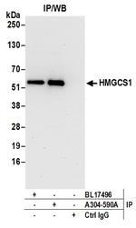 HMGCS1 Antibody in Immunoprecipitation (IP)