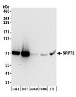 SRP72 Polyclonal Antibody