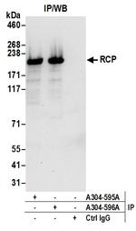RCP Antibody in Immunoprecipitation (IP)