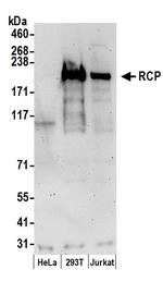 RCP Polyclonal Antibody