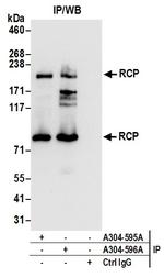 RCP Antibody in Immunoprecipitation (IP)