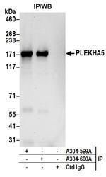 PLEKHA5 Polyclonal Antibody