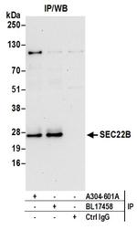 SEC22B Antibody in Immunoprecipitation (IP)