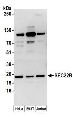 SEC22B Polyclonal Antibody