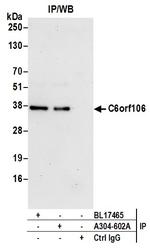 C6orf106 Antibody in Immunoprecipitation (IP)