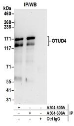 OTUD4 Antibody in Immunoprecipitation (IP)