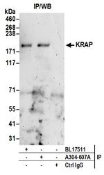 KRAP Antibody in Immunoprecipitation (IP)