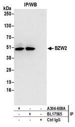 BZW2 Antibody in Immunoprecipitation (IP)