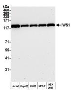 IWS1 Polyclonal Antibody