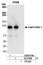 Liprin beta 1 Antibody in Immunoprecipitation (IP)