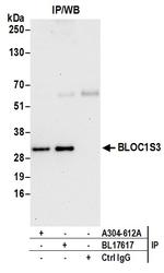 BLOC1S3 Antibody in Immunoprecipitation (IP)