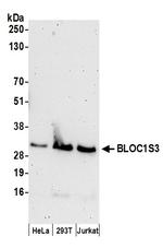 BLOC1S3 Polyclonal Antibody