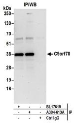 C9orf78 Polyclonal Antibody