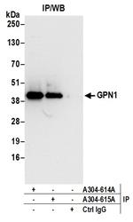 GPN1 Antibody in Immunoprecipitation (IP)