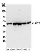 GPN1 Polyclonal Antibody