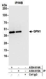 GPN1 Antibody in Immunoprecipitation (IP)