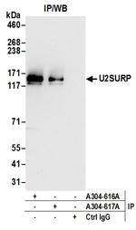 U2SURP Antibody in Immunoprecipitation (IP)