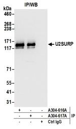 U2SURP Polyclonal Antibody