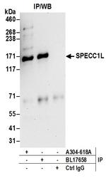 SPECC1L Polyclonal Antibody