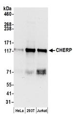 CHERP Polyclonal Antibody