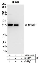 CHERP Antibody in Immunoprecipitation (IP)