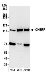 CHERP Polyclonal Antibody